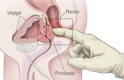 El Punto G masculino o Punto P